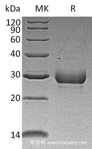 近岸蛋白CB89 Recombinant Human Noggin
